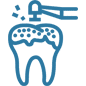 Dental sealants icon showing a tooth with protective coating application tool.
