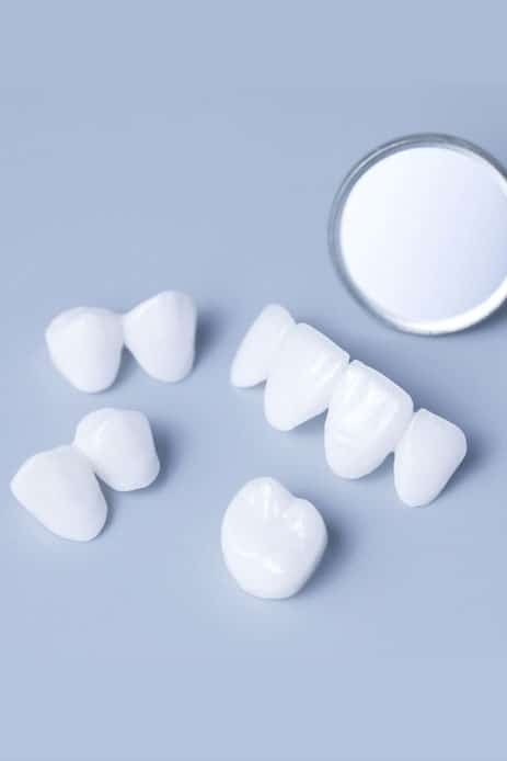 Porcelain dental crowns and veneer shade guide displayed on blue background.