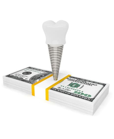 Dental implant cost comparison showing implant fixture between stacks of US dollar bills.