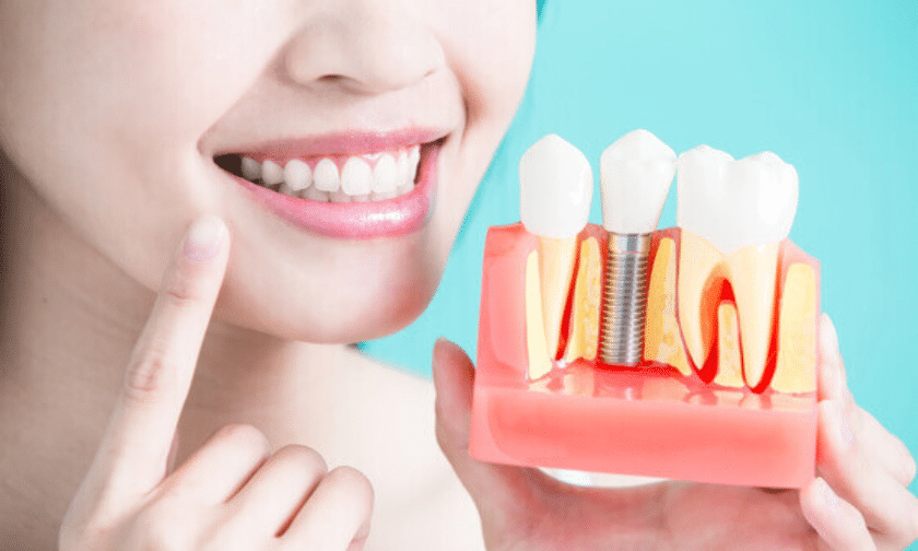 Woman smiling while holding dental implant model showing tooth replacement structure.