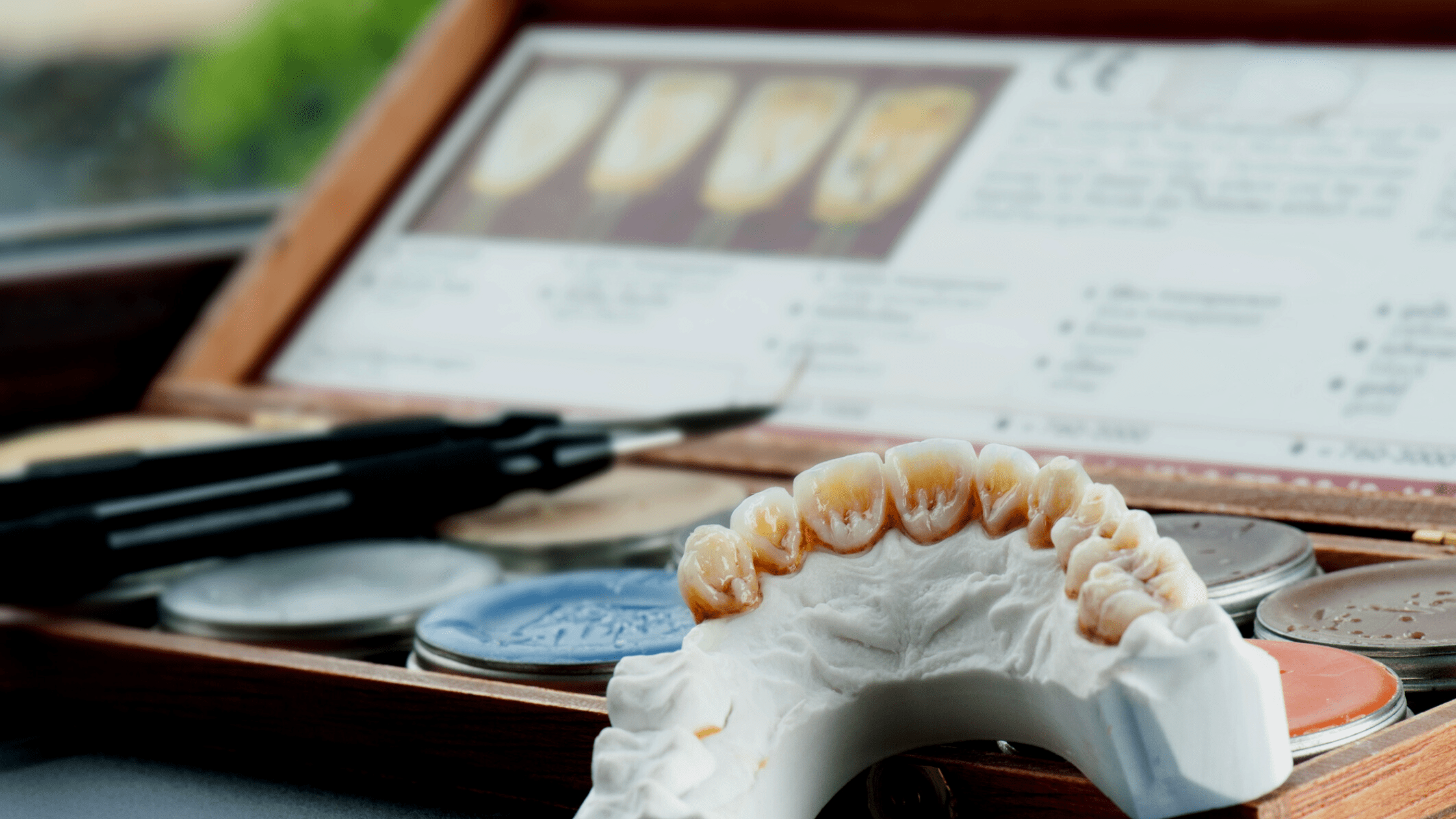 Dental crown shade samples displayed with artistic brushes and treatment planning materials in a dental office.