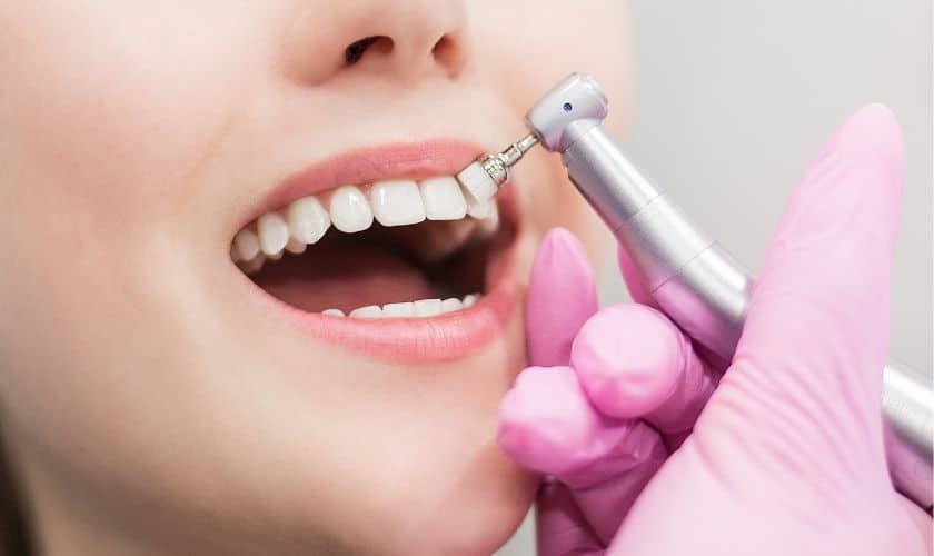 Dentist performing professional teeth whitening treatment on patient's smile.