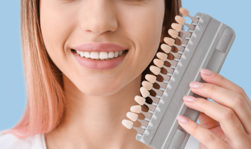 Woman displaying porcelain veneer shade guide samples next to her smile.