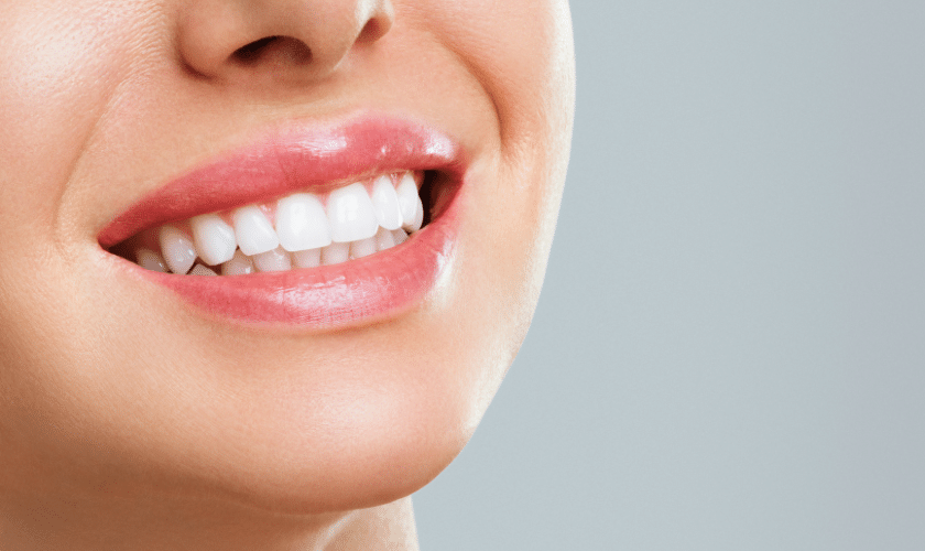 Close-up of a woman's bright white smile showing whitened teeth and healthy gums.