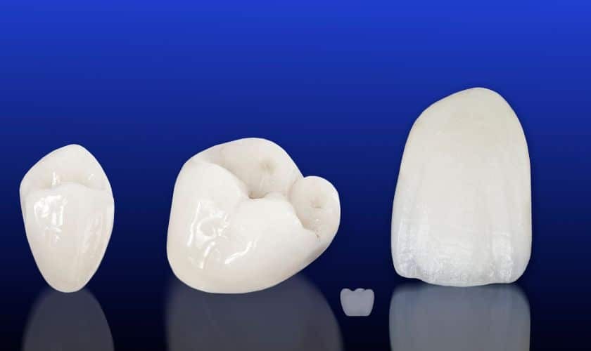 Three dental crown restorations showing different sizes on a blue background.