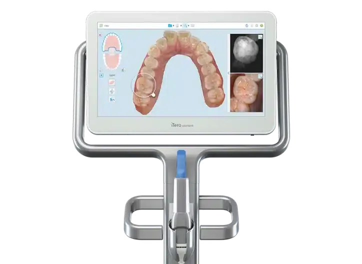iTero Element 5D digital scanner displaying 3D dental impressions and intraoral images for precise treatment planning.