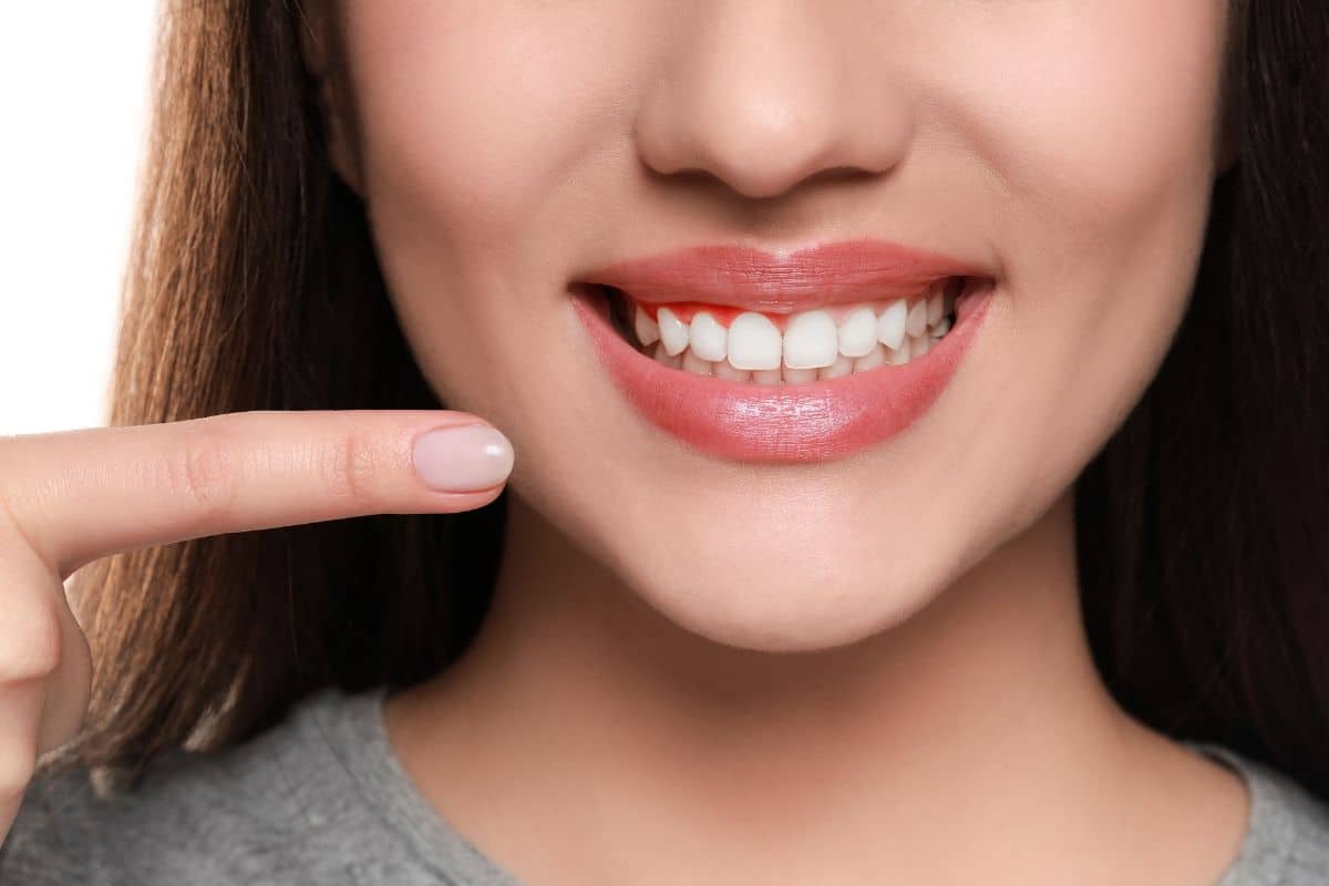 Woman with healthy white teeth and pink gums smiling, demonstrating proper gum health.