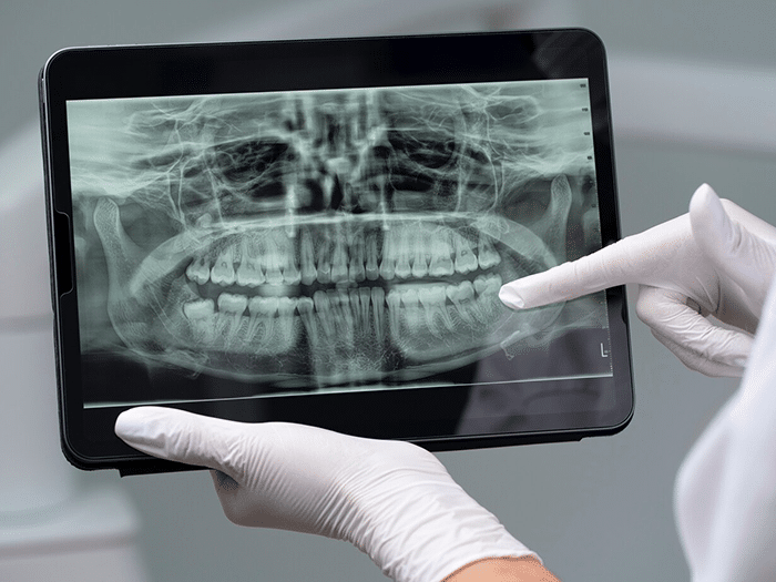 Dentist examining panoramic X-ray of patient's teeth and jaw on digital tablet.