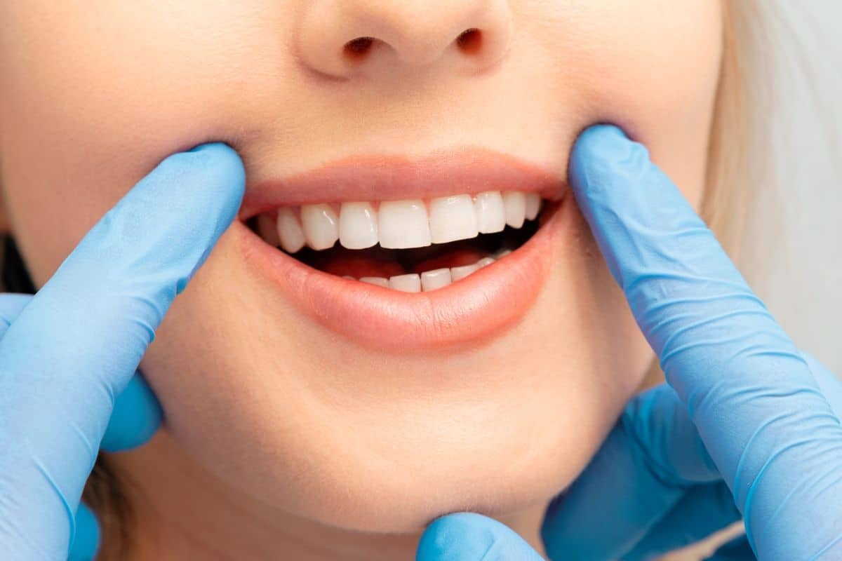 Dentist examining patient's white teeth during sensitive teeth whitening consultation.