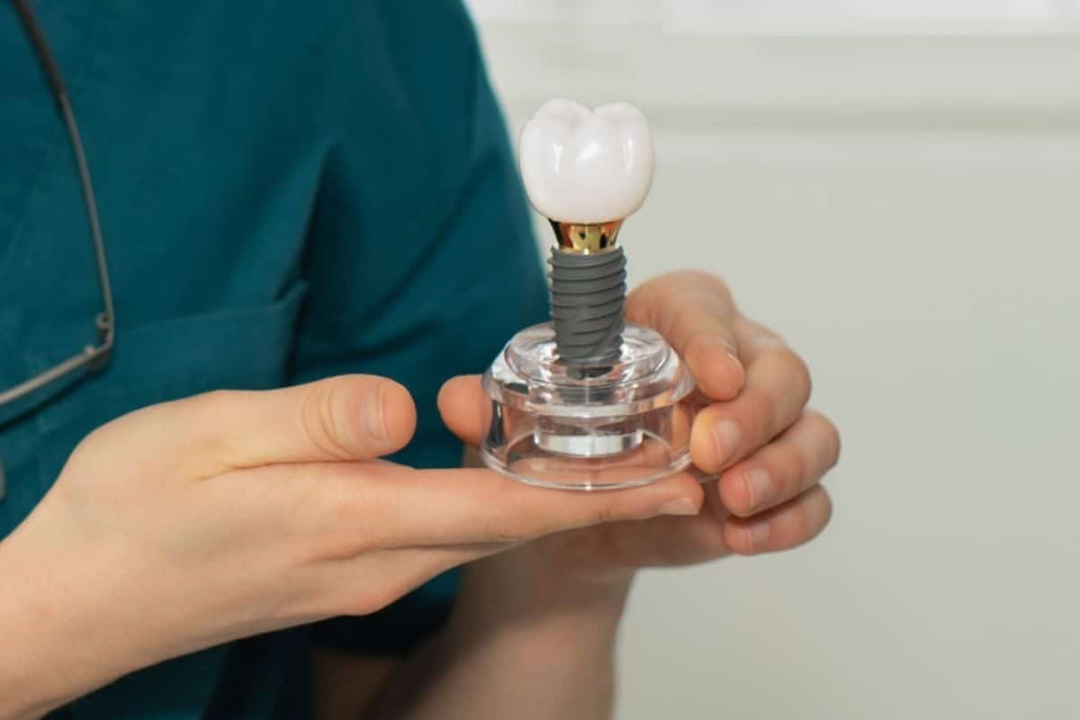 Dental implant model with white crown and screw component held in hand.