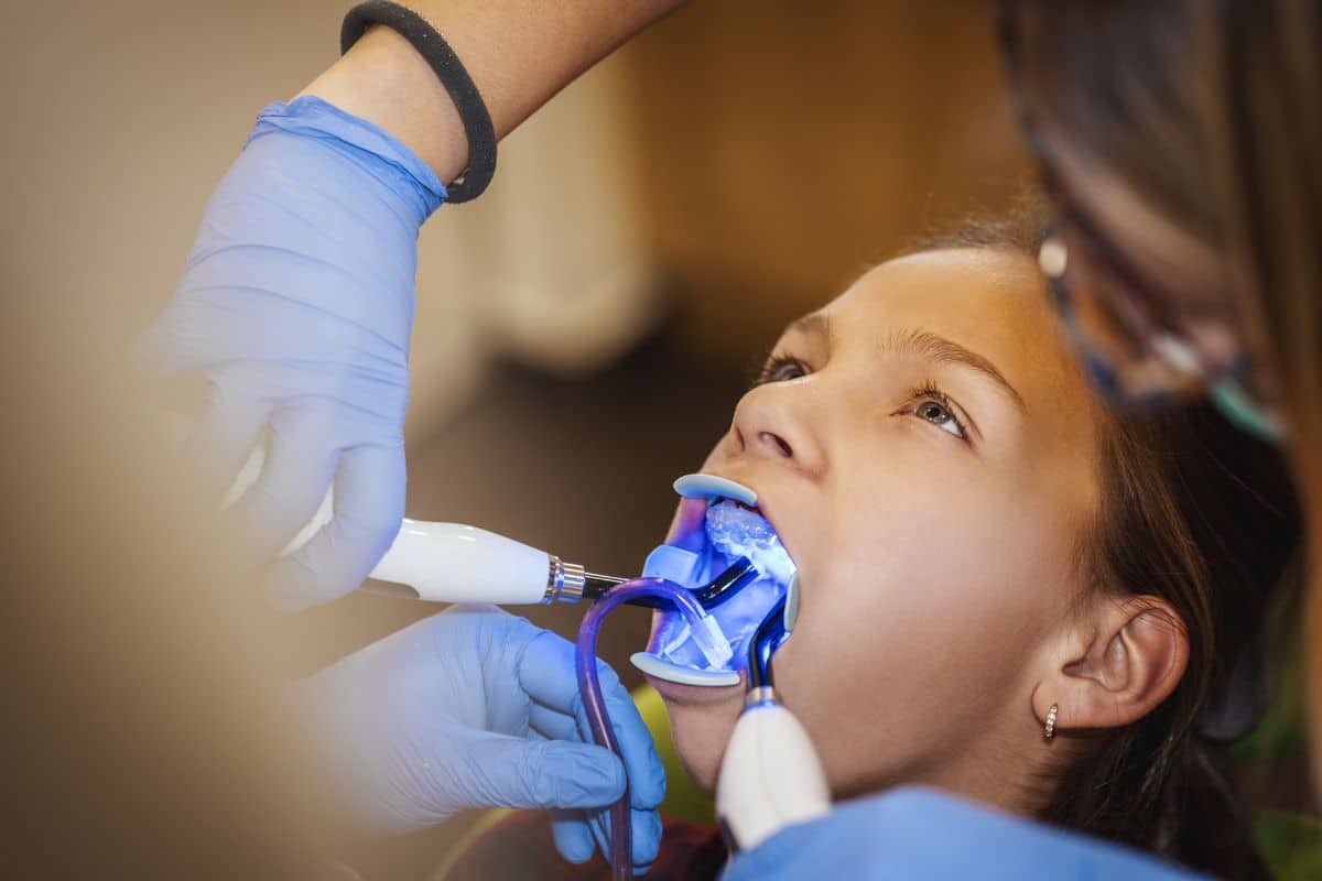 Dentist applying protective gum barrier with blue light tool during teeth whitening treatment.