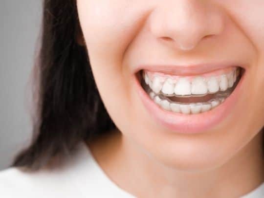 Featured image for “Can Invisalign Help with Uneven Bite Pressure?”