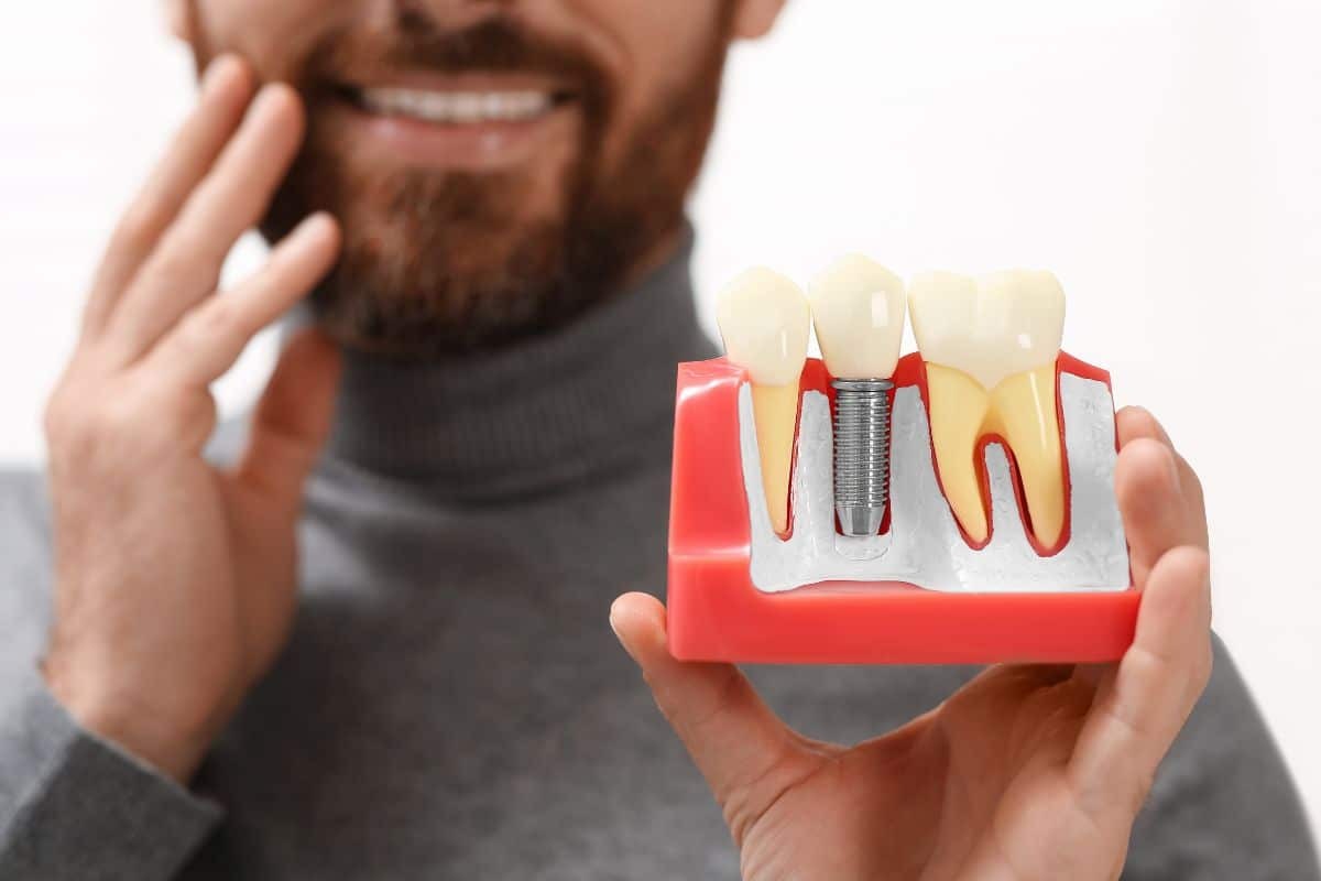 Featured image for “How Do Implants Prevent Bone Loss?”