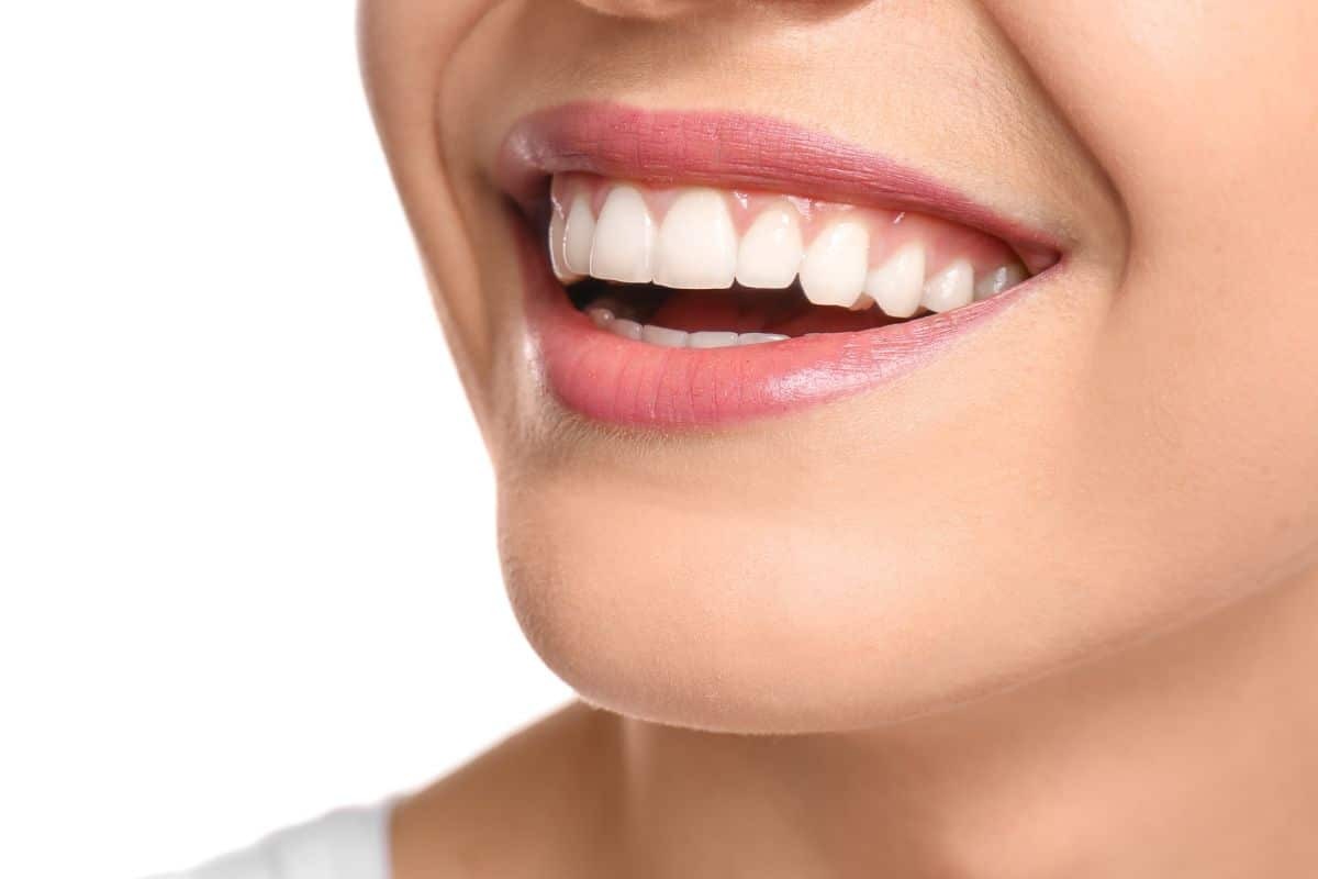 Featured image for “How White Will My Teeth Get with Whitening?”