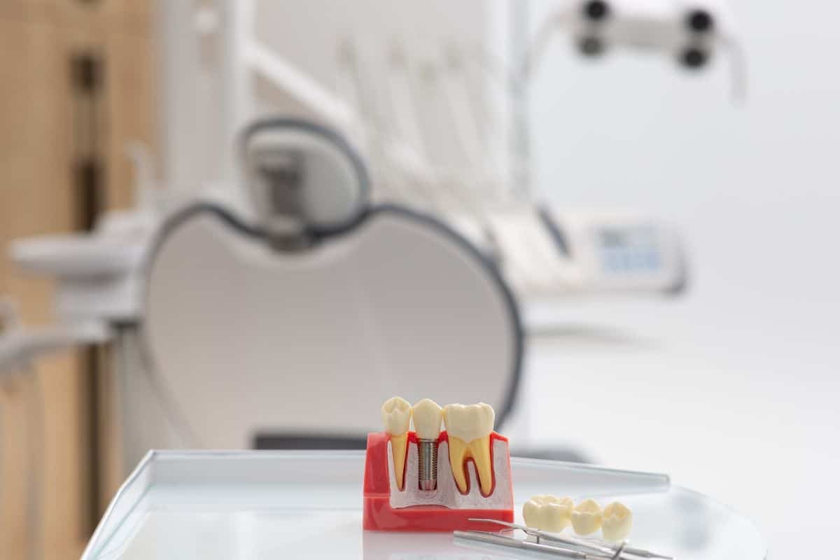 Dental implant model showing crown, abutment, and screw components in a treatment room.