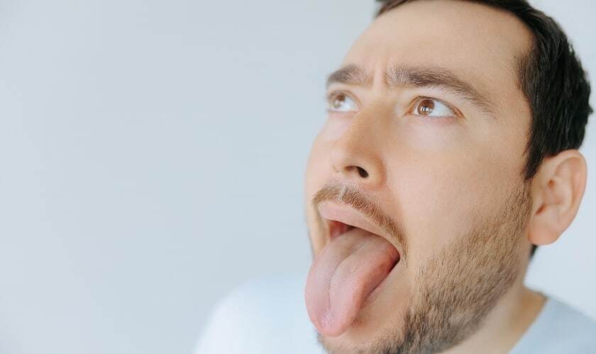 Man with tongue out showing bumps on tongue surface.