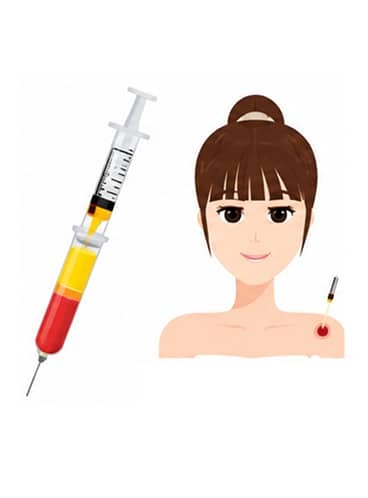 Platelet rich fibrin extraction syringe and patient illustration for dental regenerative treatment.
