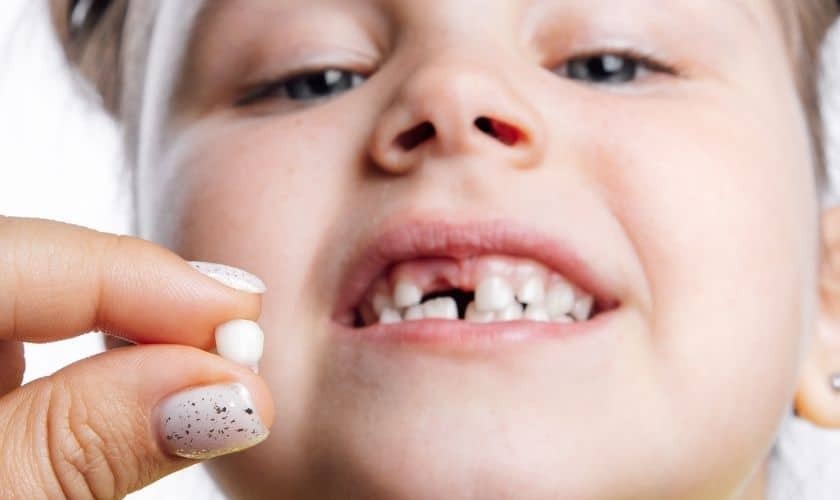 Child holding a knocked-out tooth, smiling with a gap in upper front teeth.